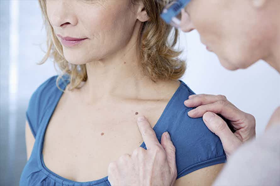 Doctor examining a women as part of skin cancer prevention